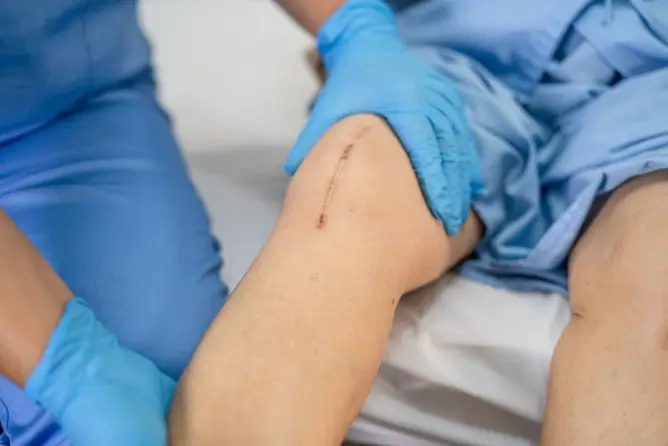 Partial-or-total-knee-replacement-Understanding-the-differences-Chris-Bailey